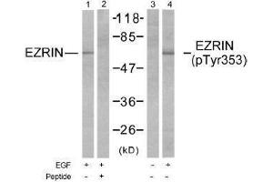 Image no. 1 for anti-Ezrin (EZR) (Tyr353) antibody (ABIN197258) (Ezrin 抗体  (Tyr353))