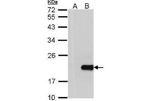 WB Image Western Blot analysis of HPCAL1 expression in transfected 293T cell line by HPCAL1 polyclonal antibody. (HPCAL1 抗体)