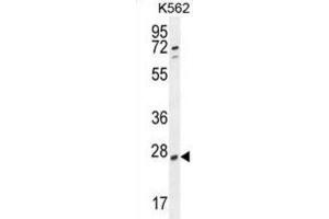 Western Blotting (WB) image for anti-Ribulose-5-Phosphate-3-Epimerase-Like (RPEL1) antibody (ABIN2995143) (Ribulose-5-Phosphate-3-Epimerase-Like (RPEL1) 抗体)