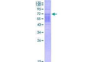 Image no. 1 for Interleukin 3 Receptor, alpha (IL3RA) (AA 19-305) protein (His-DYKDDDDK-Strep II Tag) (ABIN2752828)