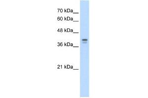 WB Suggested Anti-LOR Antibody Titration:  5. (LOR 抗体  (N-Term))