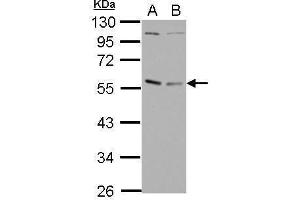WB Image Sample (30 ug of whole cell lysate) A: Raji B: K562 10% SDS PAGE antibody diluted at 1:1000 (GABPA 抗体  (N-Term))