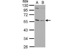 Western Blotting (WB) image for anti-GA Binding Protein Transcription Factor, alpha Subunit 60kDa (GABPA) (N-Term) antibody (ABIN2855491)