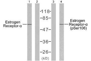 Western blot analysis of extracts from MCF7 cells using Estrogen Receptor-α (Ab-106) antibody (E021066) and Estrogen Receptor-α (phospho-Ser106) antibody (E011071). (Estrogen Receptor alpha 抗体)