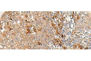 Immunohistochemistry of paraffin-embedded Human tonsil tissue using RNF207 Polyclonal Antibody at dilution of 1:40(x200) (RNF207 抗体)