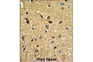 Immunohistochemistry (IHC) image for anti-Regulator of Chromosome Condensation (RCC1) and BTB (POZ) Domain Containing Protein 2 (RCBTB2) (AA 71-99), (N-Term) antibody (ABIN5536005)