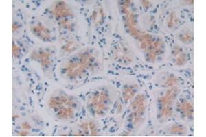 IHC-P analysis of Human Stomach Tissue, with DAB staining. (GDF6 抗体  (AA 336-455))