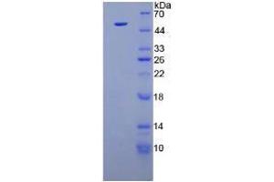 Image no. 1 for Fibroblast Growth Factor 1 (Acidic) (FGF1) (AA 1-155) (Active) protein (His tag,GST tag) (ABIN6239784)