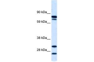 Western Blotting (WB) image for anti-Zinc Finger Protein 606 (ZNF606) antibody (ABIN2460763) (ZNF606 抗体)
