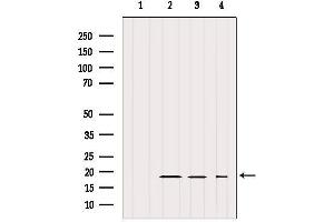 Western blot analysis of extracts from various samples, using IFT20 Antibody. (IFT20 抗体)
