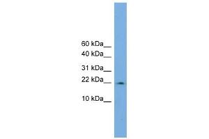 WB Suggested Anti-PPIL3 Antibody Titration:  0. (PPIL3 抗体  (Middle Region))