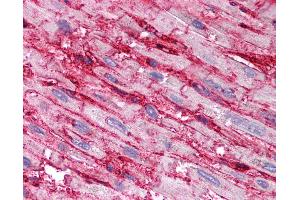 Anti-CD36 antibody IHC of human heart.