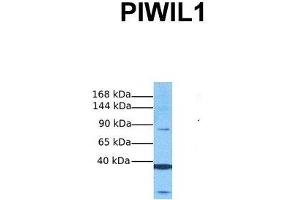 Host:  Rabbit  Target Name:  PIWIL1  Sample Tissue:  Human Fetal Liver  Antibody Dilution:  1. (PIWIL1 抗体  (Middle Region))
