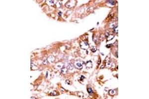 Image no. 2 for anti-Signal Transducer and Activator of Transcription 1, 91kDa (STAT1) (pSer727) antibody (ABIN358231)