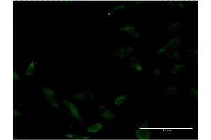 Immunofluorescence of monoclonal antibody to MUTYH on HeLa cell. (MUTYH 抗体  (AA 436-535))