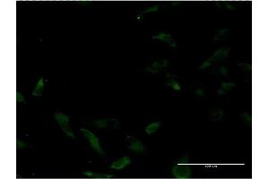 Immunofluorescence of monoclonal antibody to MUTYH on HeLa cell.