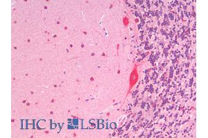 ABIN6391390 (5µg/ml) staining of paraffin embedded Human Cerebellum. (SLC7A6 抗体  (C-Term))