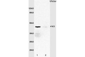 L1 rat spleen lysates L2 mouse heart lysates probed with Anti IL-2R gamma/CD132 Polyclonal Antibody, Unconjugated  at 1:3000 for 90 min at 37˚C. (IL2RG 抗体  (AA 51-150))
