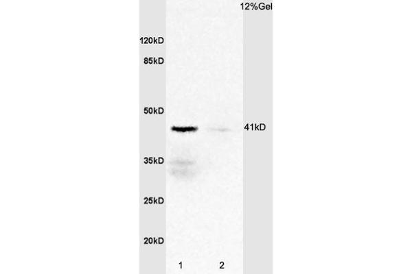 IL2RG 抗体  (AA 51-150)