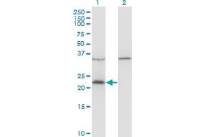 Western Blot analysis of VAX1 expression in transfected 293T cell line by VAX1 monoclonal antibody (M03), clone 2F4. (VAX1 抗体  (AA 1-100))