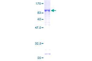 PARP3 Protein (AA 1-533) (GST tag)