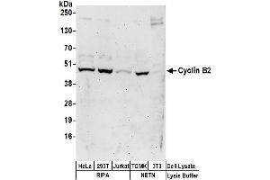 anti-Cyclin B2 (CCNB2) (AA 1-50) antibody