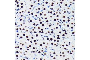 Immunohistochemistry of paraffin-embedded rat ovary using TDP-43/TARDB Rabbit mAb (ABIN7270730) at dilution of 1:100 (40x lens). (TARDBP 抗体)