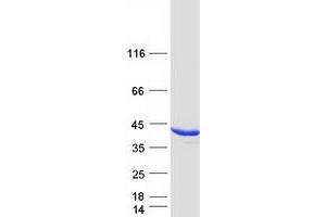 Western Blotting (WB) image for Aldo-keto Reductase Family 1 Member C4 (AKR1C4) protein (Myc-DYKDDDDK Tag) (ABIN2714506)