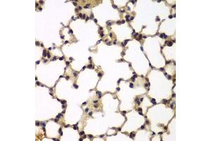 Immunohistochemistry of paraffin-embedded mouse lung using E2F6 antibody. (E2F6 抗体)