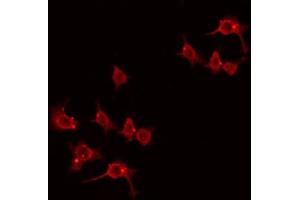 ABIN6274438 staining Hela by IF/ICC. (LMO3 抗体  (C-Term))