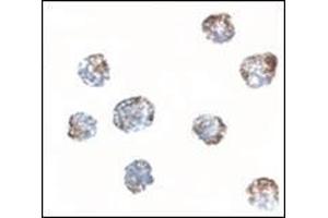 Immunocytochemistry of MATN3 in 3T3 cells tissue with this product at 2. (Matrilin 3 抗体  (Center))