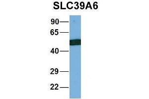 Western Blotting (WB) image for anti-Solute Carrier Family 39 (Zinc Transporter), Member 6 (SLC39A6) (Middle Region) antibody (ABIN2781630)