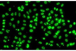 Immunofluorescence analysis of A549 cells using CSRNP1 Polyclonal Antibody (AXUD1 抗体)