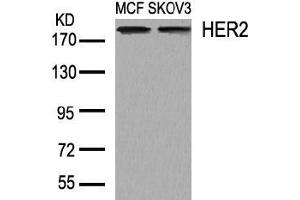 Image no. 2 for anti-Receptor tyrosine-protein kinase erbB-2 (ErbB2/Her2) (AA 1246-1250) antibody (ABIN197227) (ErbB2/Her2 抗体  (AA 1246-1250))