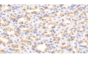 Immunohistochemistry (IHC) image for anti-Mitogen-Activated Protein Kinase 1 (MAPK1) (AA 25-360) antibody (ABIN7445753)
