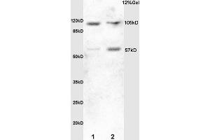 Lane 1: mouse embryo lysates Lane 2:rat brain lysates probed with Anti HSF1 Polyclonal Antibody, Unconjugated (ABIN703676) at 1:200 in 4 °C. (HSF1 抗体  (AA 351-450))