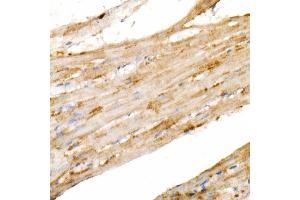 Immunohistochemistry of paraffin-embedded rat heart using PGC1α Rabbit mAb  at dilution of 1:1000 (40x lens). (PPARGC1A 抗体)