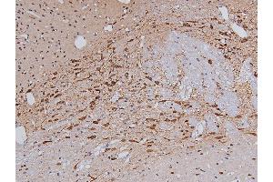 ABIN6267326 at 1/200 staining Rat brain tissue sections by IHC-P. (Tyrosine Hydroxylase 抗体  (pSer40))