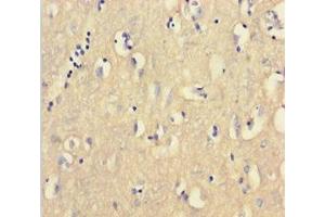 Immunohistochemistry of paraffin-embedded human brain tissue using ABIN7147334 at dilution of 1:100 (CNBP 抗体  (AA 2-170))