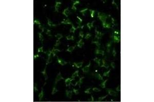 Immunofluorescence analysis of CA9 Antibody (Center) with hela cells. (CA9 抗体  (AA 113-143))