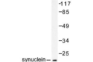 Image no. 1 for anti-Synuclein, alpha (SNCA) antibody (ABIN271837) (SNCA 抗体)