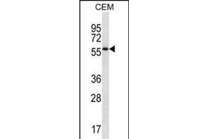 MOSPD2 Antibody (N-term ) (ABIN657246 and ABIN2846344) western blot analysis in CEM cell line lysates (35 μg/lane). (MOSPD2 抗体  (N-Term))