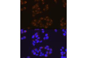 Immunofluorescence analysis of HeLa cells using APP Rabbit mAb (ABIN7265575) at dilution of 1:100 (40x lens).