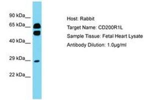Image no. 1 for anti-CD200 Receptor 1-Like (CD200R1L) (AA 87-136) antibody (ABIN6750795) (CD200R1L 抗体  (AA 87-136))