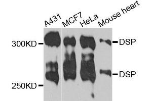 Western blot analysis of extracts of various cells, using DSP antibody. (Desmoplakin 抗体)