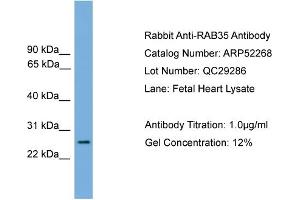 WB Suggested Anti-RAB35  Antibody Titration: 0.