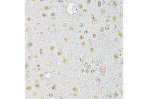 Immunohistochemistry of paraffin-embedded rat brain using HDAC3 Antibody (ABIN1872955) at dilution of 1:100 (40x lens). (HDAC3 抗体)