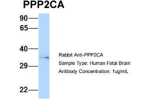 Host: Rabbit  Target Name: PPP2CA  Sample Tissue: Human Fetal Brain  Antibody Dilution: 1. (PPP2CA 抗体  (N-Term))