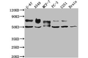 Western Blot Positive WB detected in: U-87 whole cell lysate, A549 whole cell lysate, MCF-7 whole cell lysate, PC-3 whole cell lysate, U-251 whole cell lysate, Mouse Brain whole cell lysate All lanes: 5T4 antibody at 1:1000 Secondary Goat polyclonal to rabbit IgG at 1/50000 dilution Predicted band size: 47 kDa Observed band size: 50, 80 kDa (Recombinant TPBG 抗体)