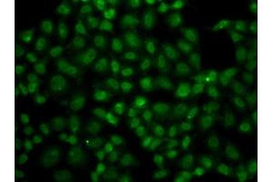 Immunofluorescence analysis of A549 cells using USP26 antibody. (USP26 抗体  (AA 664-913))